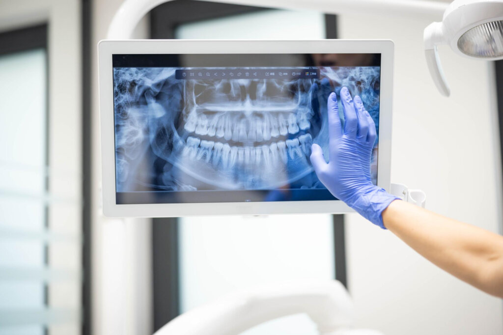 תכנון שיקום דיגיטלי